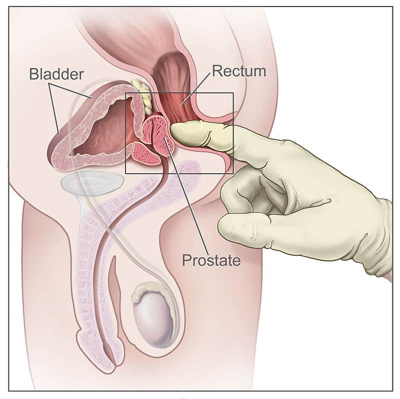 How to Find the Male Prostate A Beginner’s Guide to Prostate Location