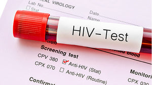 HIV Tests and diagnosis