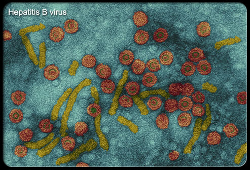 HEPATITIS