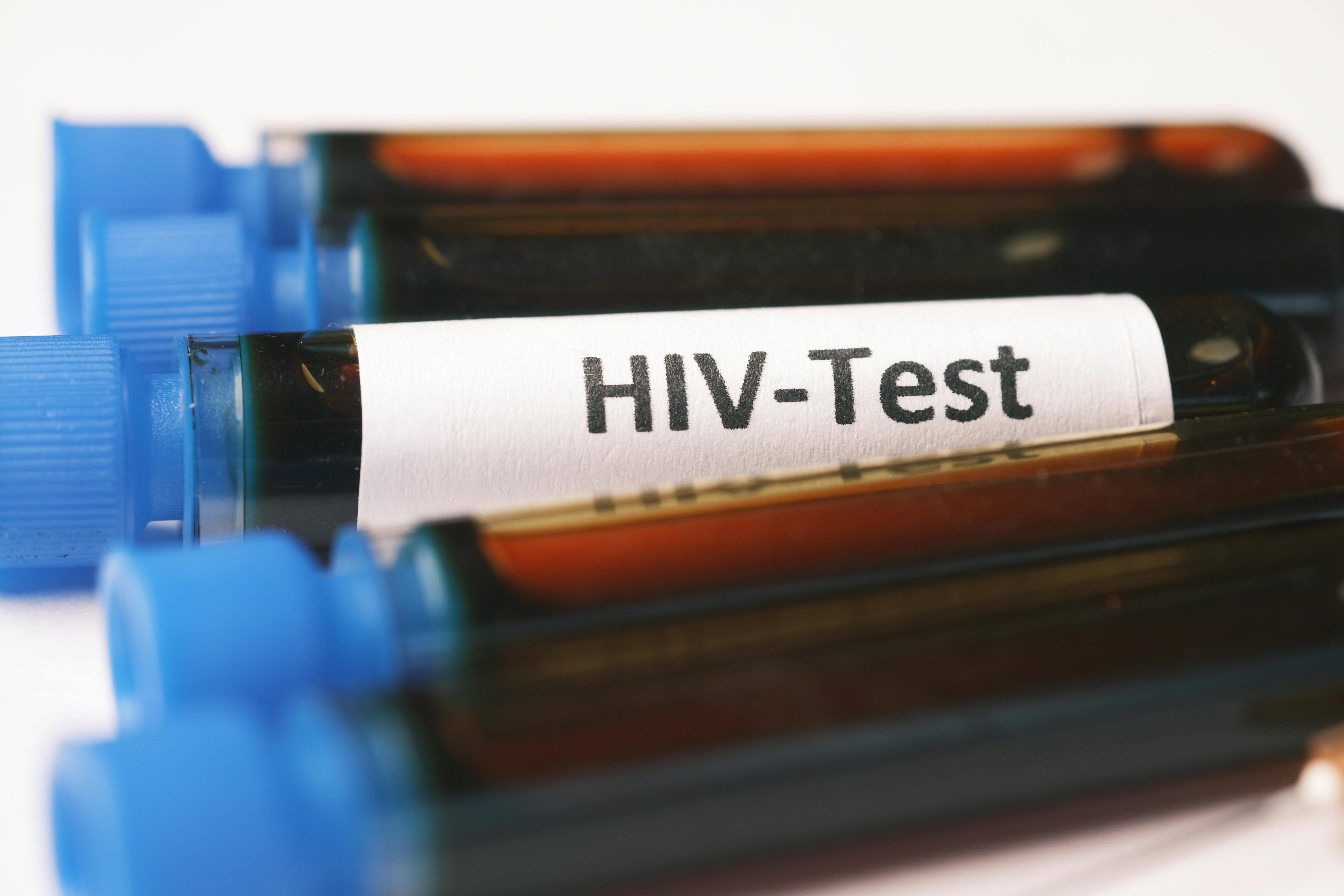 WHAT IS HIV
