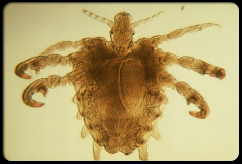 Pubic Lice (Crabs)